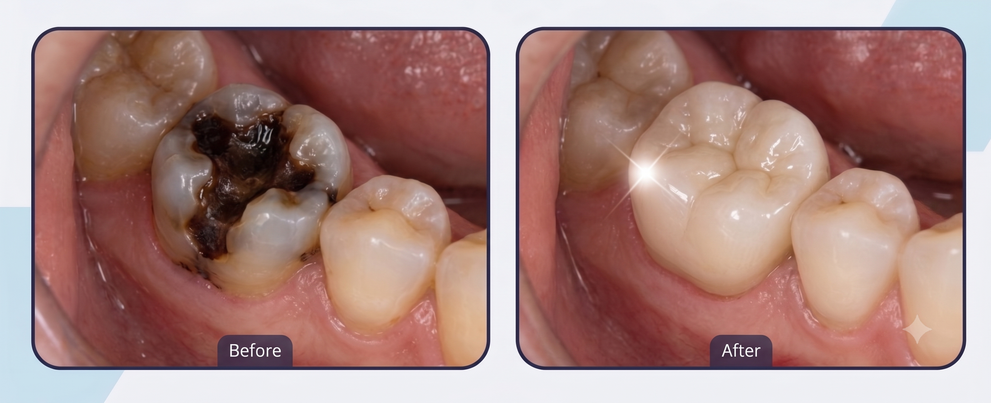 Smile Transformation 3 - White Orchid Dental Clinic